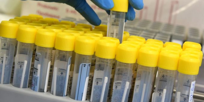 Im Labor wird die Analyse von PCR-Tests vorbereitet. Im Labor wird die Analyse von PCR-Tests vorbereitet.