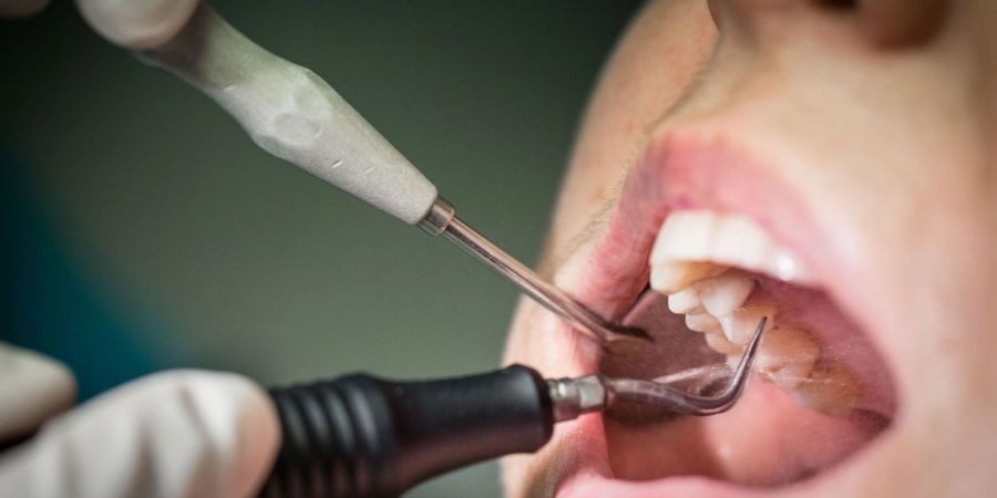 Wer regelmässig zur Vorsorge geht und seine Zähne professionell reinigen lässt, kann Parodontitis vorbeugen. Besonders wichtig ist das für Diabetiker.