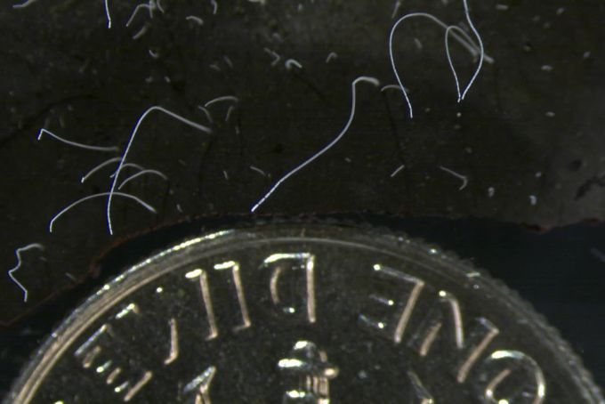 Das Bakterium weist Merkmale tierischer und pflanzlicher Zellen auf. Bakterium