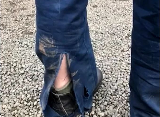 Känguru Verletzung Jeans