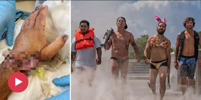 Durchgeknallter Stunt - Jackass-Star wird von Hai in die Hand gebissen