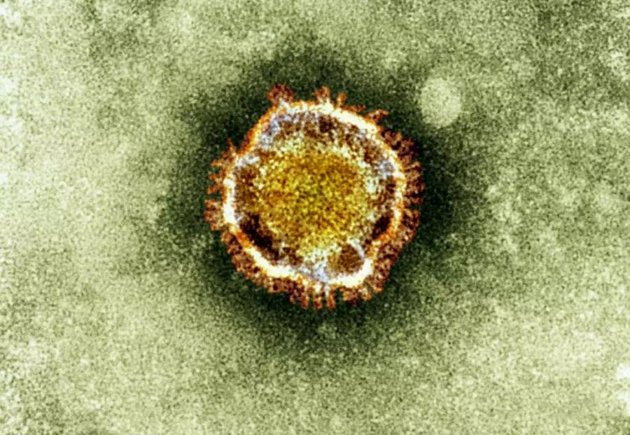 Coronavirus