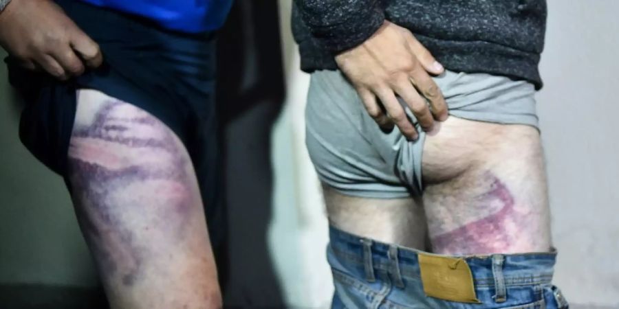 Freigelassene Demonstranten mit Folterspuren
