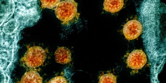 Diese vom «National Institute of Allergy and Infectious Diseases Integrated Research Facility» zur Verfügung gestellte elektronenmikroskopische Aufnahme aus dem Jahr 2020 wurde farblich bearbeitet und zeigt Partikel des Coronavirus SARS-CoV-2, (in Orange), die von einem Patienten isoliert wurden. neue corona variante