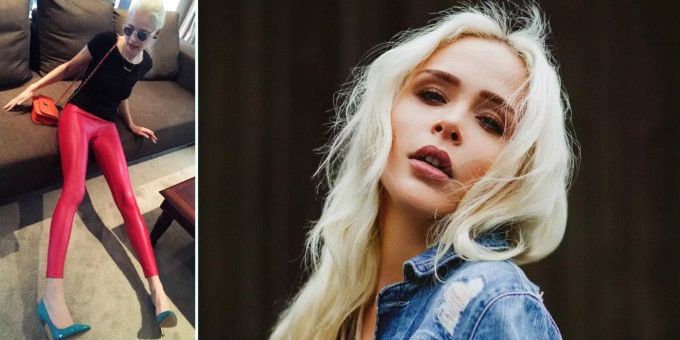 Nun 8,5 cm grösser - «GNTM»-Model liess sich seine Beine brechen