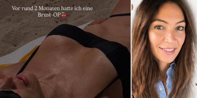 brust-op