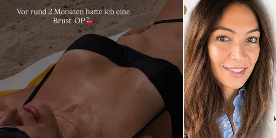 brust-op