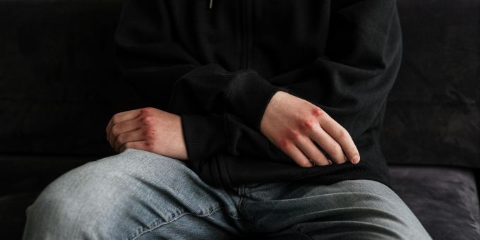 In den letzten Jahren gab es rund 60 Prozent mehr Delikte von unter 15-Jährigen. Berikon