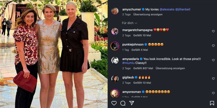 amy schumer