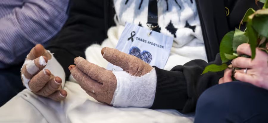 Sie können nicht sprechen, die Hände sind dick einbandagiert.