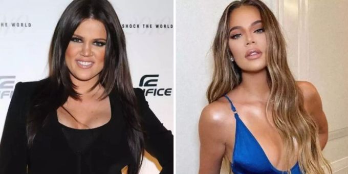 Teurer Beauty-Wahn - Khloé Kardashians Look kostete 47'000 Franken