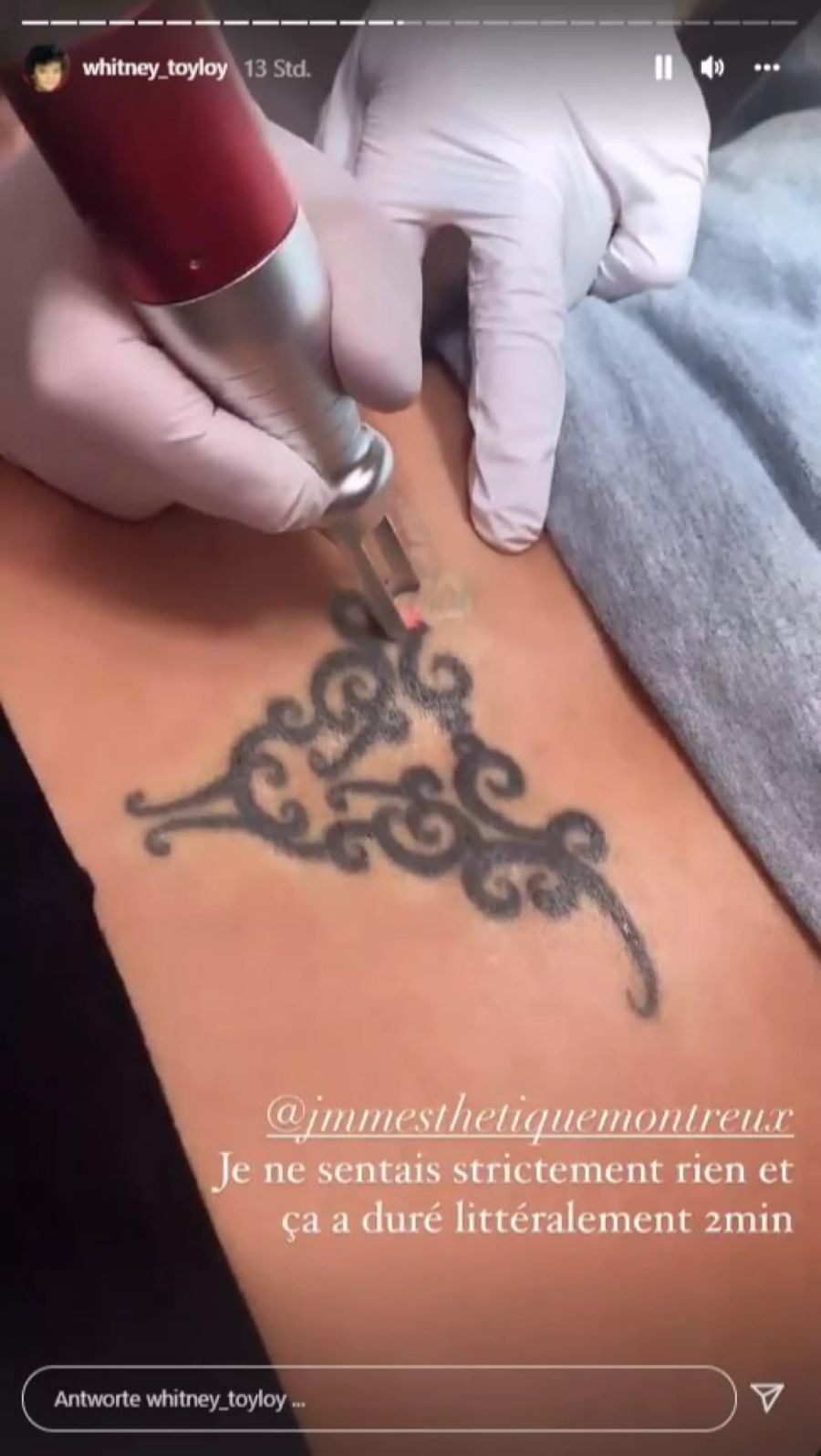 Dem Tatto geht es nun an den Kragen.