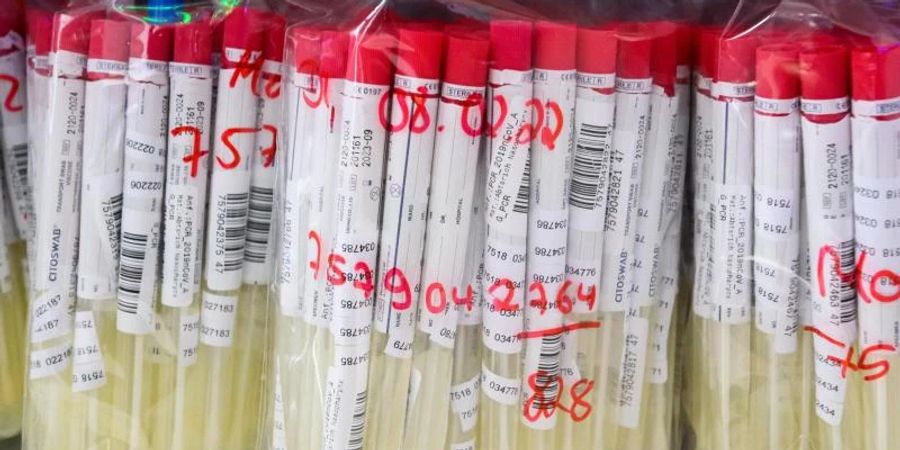 PCR-Tests einem im Labor. Foto: Julian Stratenschulte/dpa