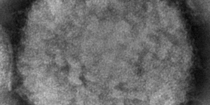 Die elektronenmikroskopische Aufnahme zeigt ein Affenpockenvirus. affenpocken