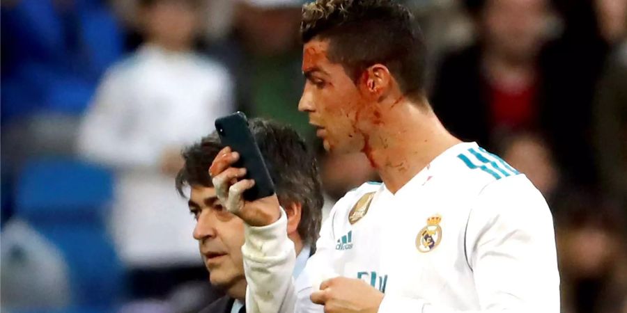 Real Madrid schiesst sich beim 7:1 gegen La Coruna den Frust von der Seele. Ronaldo glänzt mit zwei Toren. Kurz vor Schluss wird er vom Schweizer Fabian Schär am Kopf getroffen. Und wie es sich für Ronaldo gehört, prüft er noch auf dem Feld, ob sein Aussehen gelitten hat – per Handy. Das Bild des Wochenendes.