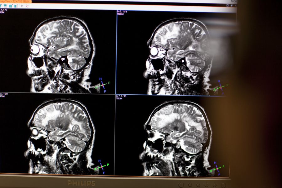 Denn sobald sich eine Aufgabe leicht verändert, wird die Fehlerquote automatisch höher.