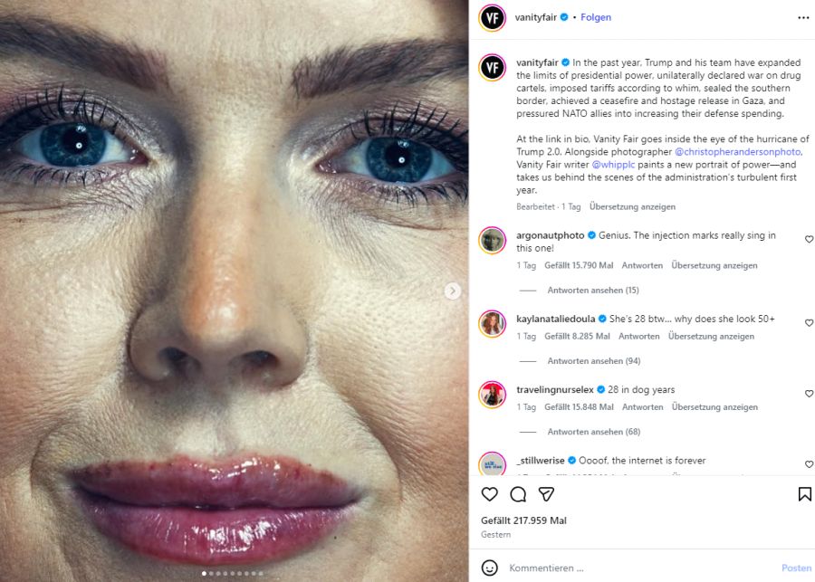 Die roten Pünktchen an Karoline Leavitts Oberlippe deuten auf Lipfiller hin.