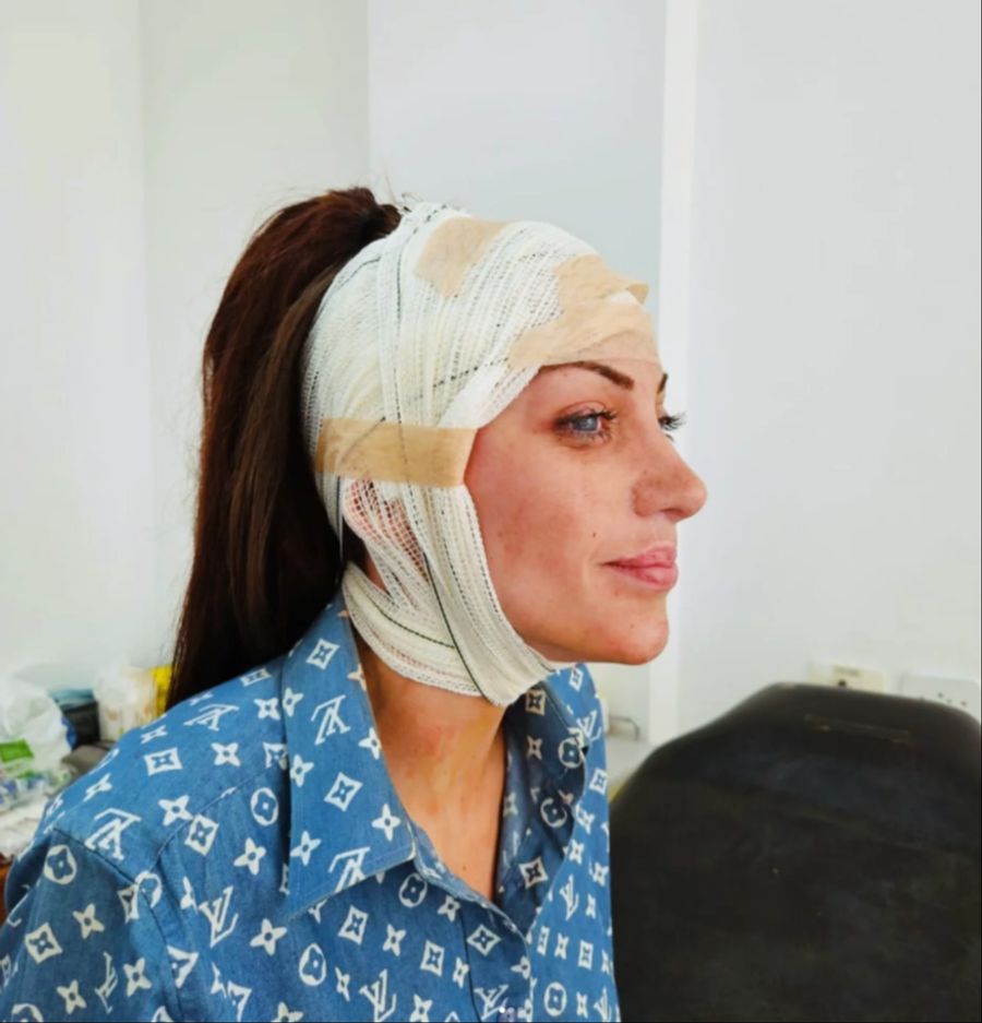 27-mal legte sie sich für Schönheits-Operationen unters Messer.