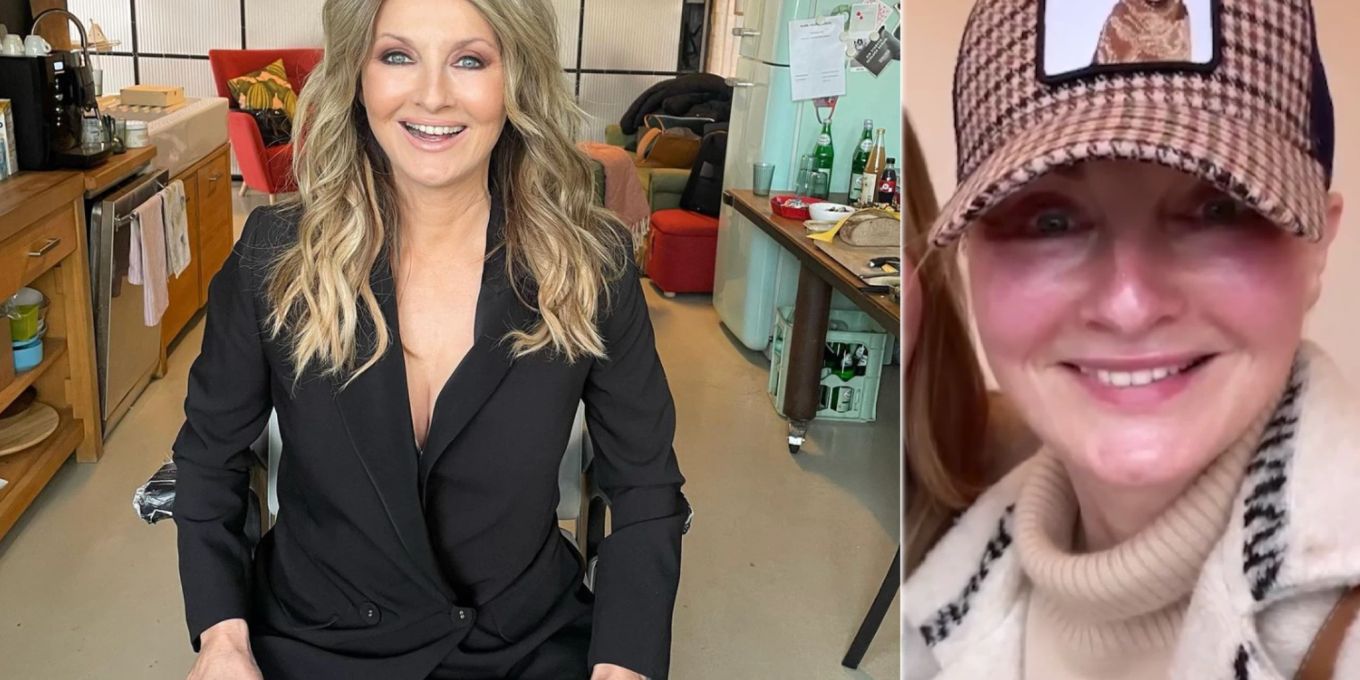 RTL Star Frauke Ludowig Zeigt Sich Nach Beauty Eingriff Nau ch rtl-star-frauke-ludowig-zeigt-sich-nach-beauty-eingriff-nau-ch