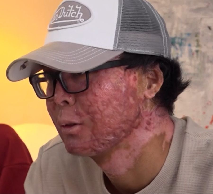 Kean wünscht sich, wieder 100-prozentig selbständig zu sein.