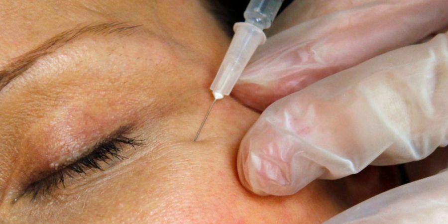 Zwei Frauen aus der Ukraine boten illegal Behandlungen mit Botox, Hyaluronfillern und Lasergeräten an. (Symbolbild)