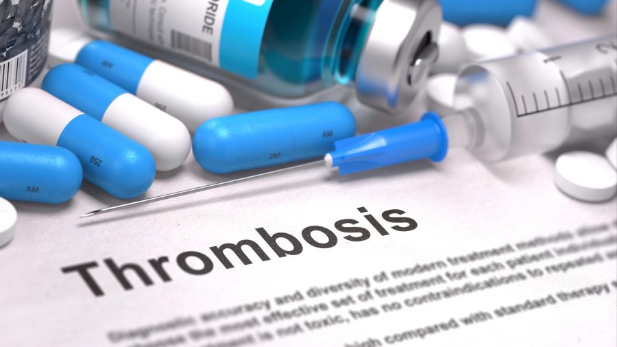 Thrombose Diagnose