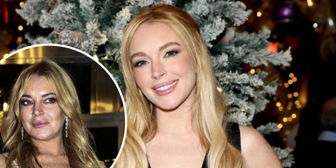 Beauty-OPs - Arzt glaubt: Lindsay Lohan gab bis zu 280'000 Franken aus