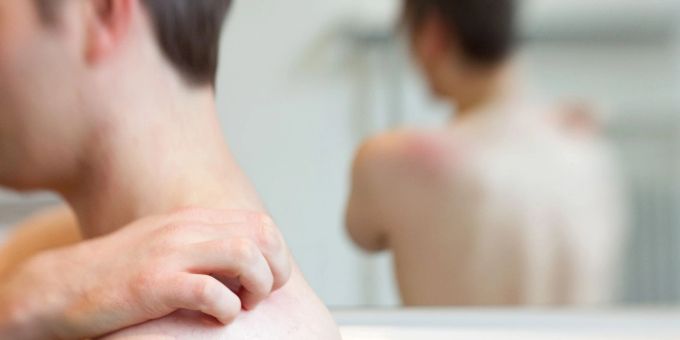 Hautbläschen und Juckreiz sind typische Symptome der Gürtelrose. gürtelrose impfung