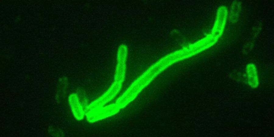 Und so sieht der Pesterreger, das Yersinia pestis-Bakterium, aus. Bild: Wikimedia Commons