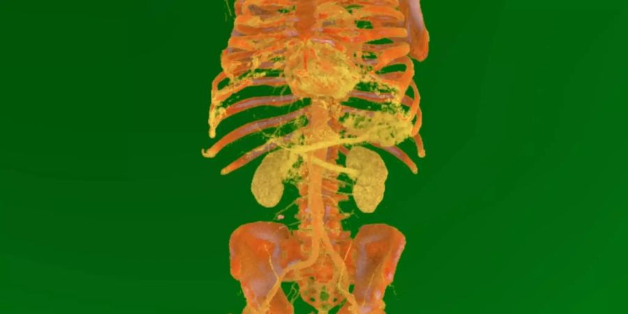 Virtuelles Modell des Torsos eines Patienten.
