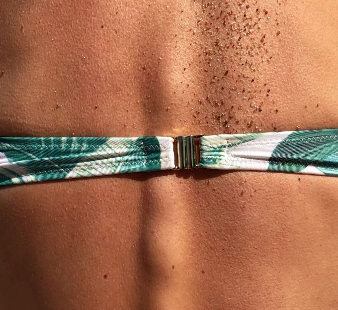 Noch Bräune oder schon Hautkrebs? Rücken Frau Bikini