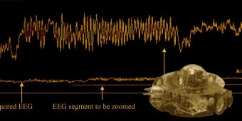 EEG Aufzeichnung Roboter