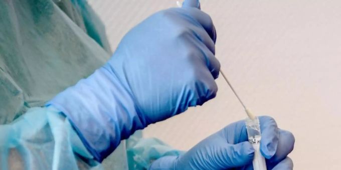 Team Russischer Forscher will Patienten ohne Polymerase-Kettenreaktion auf Covid testen. polymerase-kettenreaktion