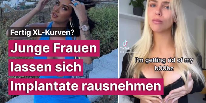 Fertig XL-Kurven? - Junge Frauen lassen sich Implantate rausnehmen Fertig XL-Kurven? - Junge Frauen lassen sich Implantate rausnehmen
