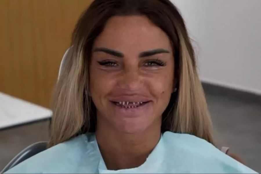 Fake-Zähne liegen im Trend. Die Schweizerische Zahnärzte-Gesellschaft SSO warnt vor unseriösen Anbietern. Katie Price zum Beispiel trägt keine Veneers ...