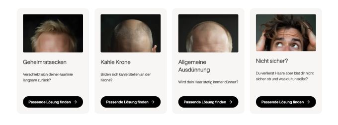 So unterschiedlich kann Haarausfall sein. Everyman Health