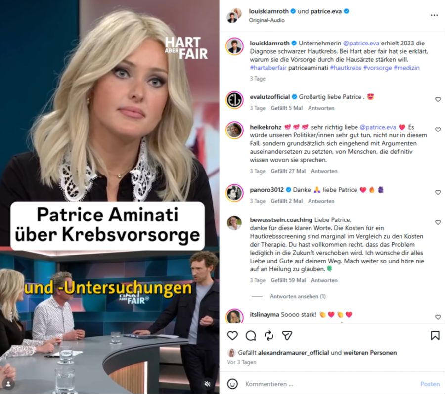 Patrice Aminati nutzt ihre Talk-Show-Auftritte, um für ihr Herzensthema, die Hautkrebsvorsorge, zu werben.