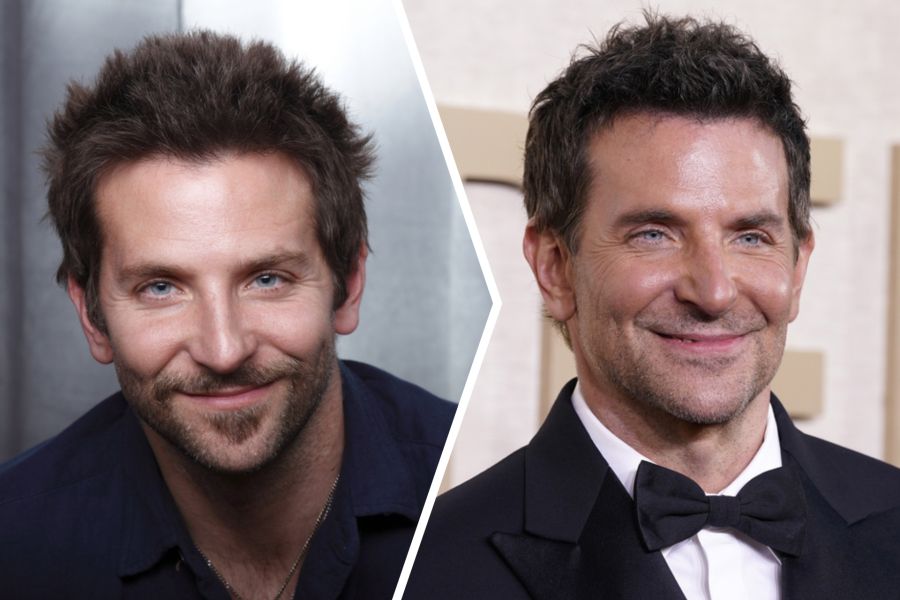 Sie sagt: «Mit grosser Wahrscheinlichkeit hatte er ein Deep-Plane-Facelifting.» (Im Bild: Der Vorher- / Nachher-Vergleich)