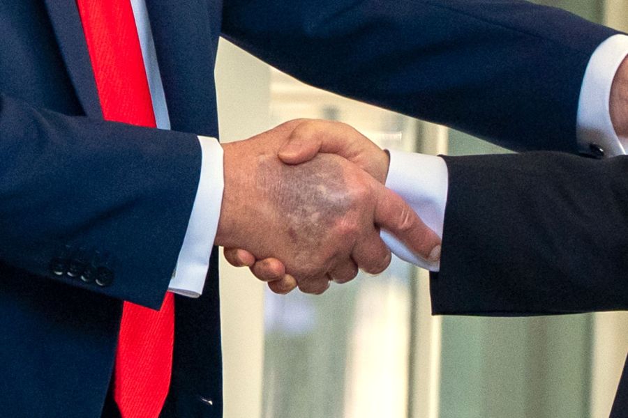 Erst kürzlich wurde Trump mit einem Bluterguss auf seiner rechten Hand fotografiert.