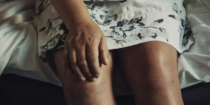 Arthrose kann sehr schmerzhaft sein. (Symbolbild) Cannabidiol