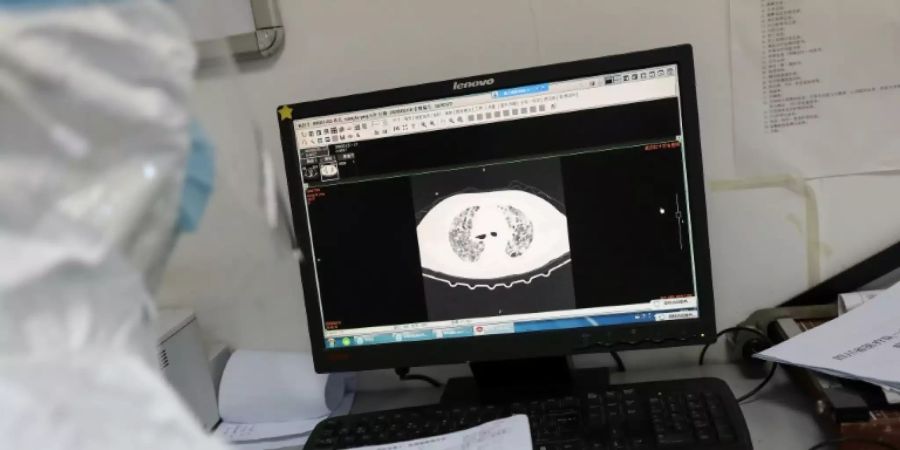 Lungen-Scan in chinesischem Krankenhaus