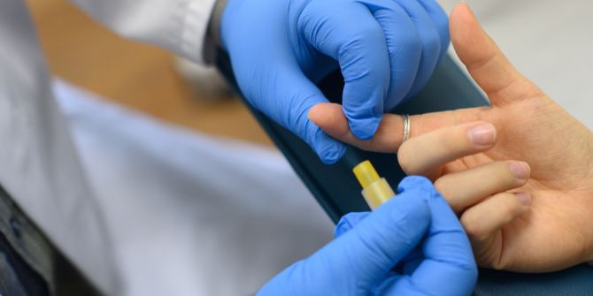 Gratis-Tests Geschlechtskrankheiten Zürich Pilotprojekt