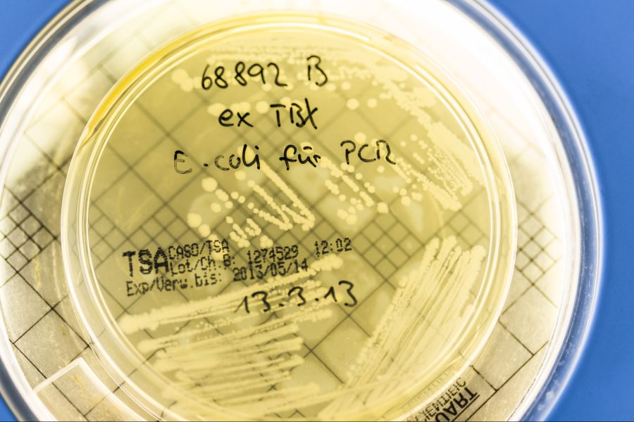 Der Käse war mit Escherichia-coli-Bakterien (E. coli) belastet.