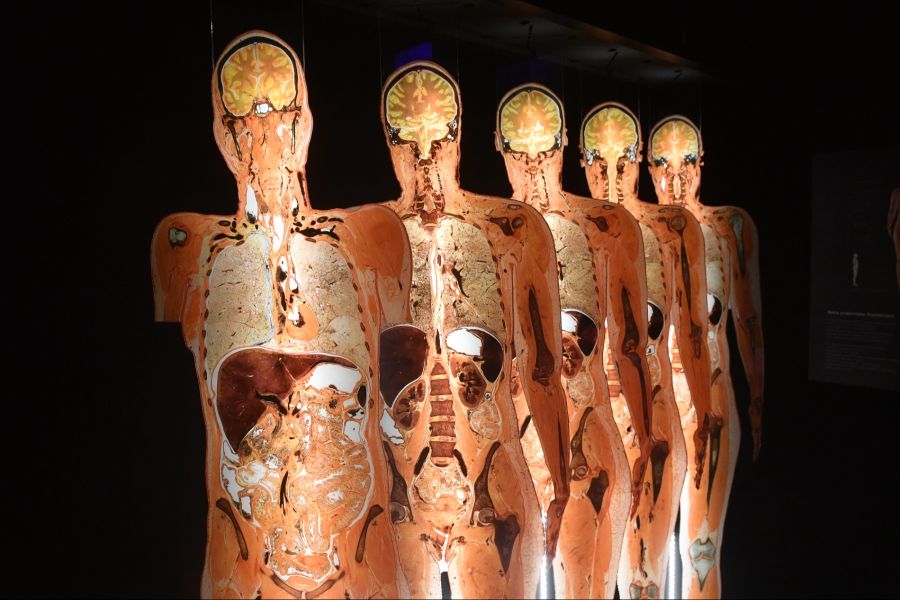 Plastinate