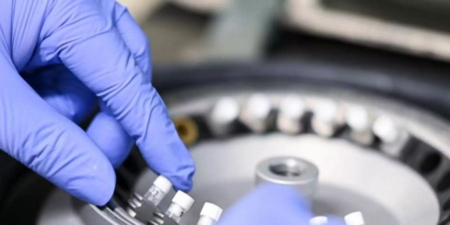 Virus-Diagnostik im Labor. Der Deutsche Ethikrat ist gegen die Einführung von Corona-Immunitätsnachweisen. Foto: Felix Kästle/dpa
