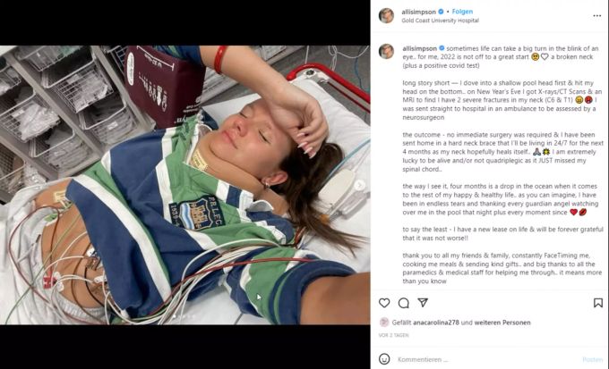 Alli Simposon nach ihrem Unfall im Krankenhaus Southport. Alli Simpson