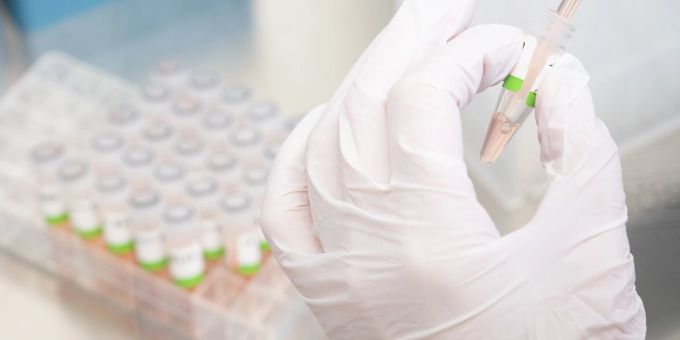 Eine biologisch-technische Assistentin bereitet PCR-Tests auf das Coronavirus vor. Eine biologisch-technische Assistentin bereitet PCR-Tests auf das Coronavirus vor.
