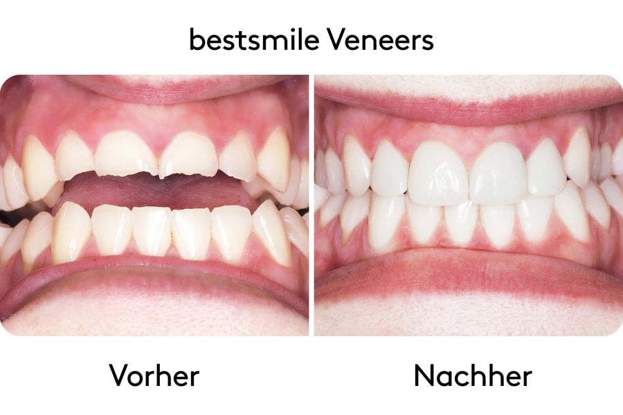 Vorher-Nachher Bilder