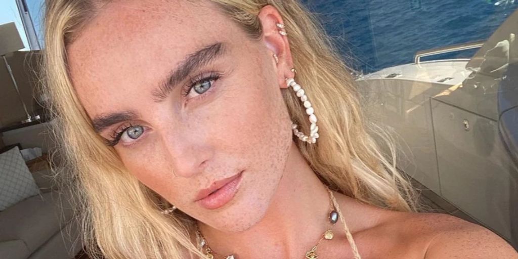 Singer Perrie Edwards wanted to remove freckles with acid