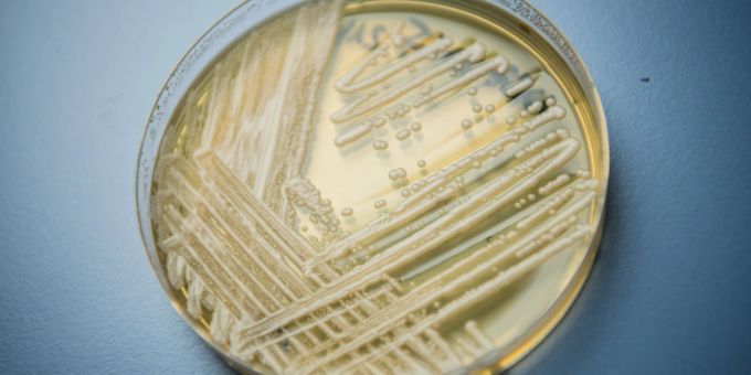 Der Hefepilz Candida auris in einer Petrischale. Die Weltgesundheitsorganisation (WHO) ist besorgt über 19 kranheitserregende Pilze, die nach Expertenansicht die öffentliche Gesundheit bedrohen. Der Hefepilz Candida auris in einer Petrischale. Die Weltgesundheitsorganisation (WHO) ist besorgt über 19 kranheitserregende Pilze, die nach Expertenansicht die öffentliche Gesundheit bedrohen.